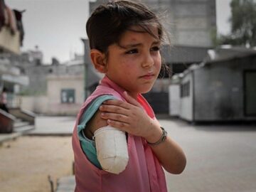سازمان ملل: غزه وطن بزرگترین گروه از کودکان قطع عضو شده است