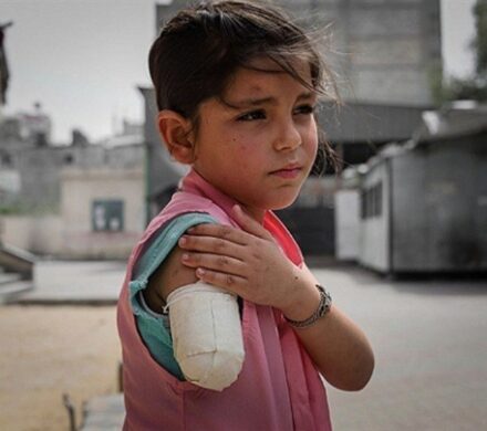 سازمان ملل: غزه وطن بزرگترین گروه از کودکان قطع عضو شده است