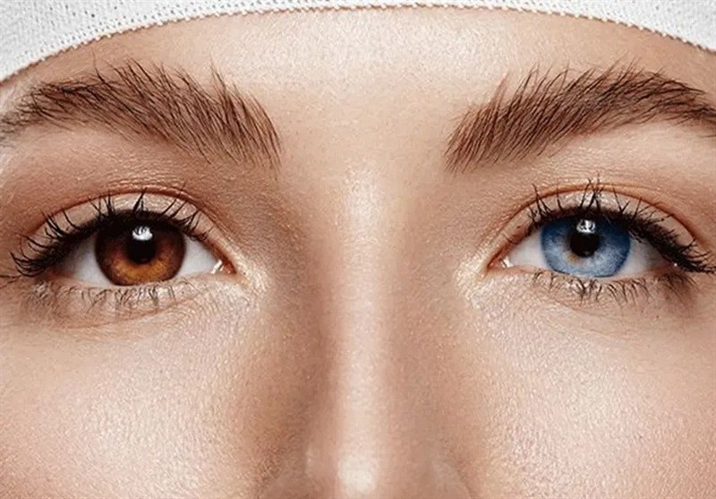 ترغیب مردم به انجام جراحی ممنوعه در خارج از کشور تخلف است