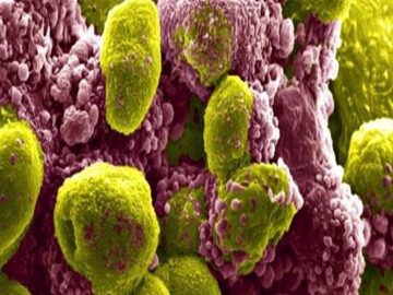 تاثیر یک ترکیب دارویی در کاهش خطر مرگ ناشی از سرطان