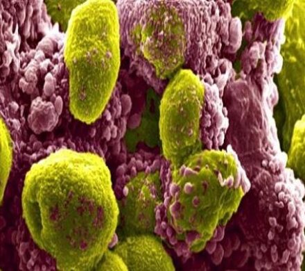 تاثیر یک ترکیب دارویی در کاهش خطر مرگ ناشی از سرطان